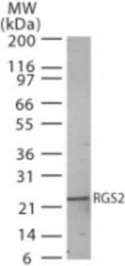 Invitrogen RGS2 Polyclonal Antibody 100 &mu;g | Buy Online | Invitrogen&trade; | Fisher Scientific