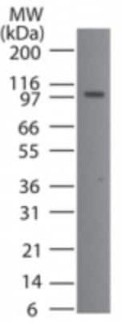 Invitrogen TMEM123 Polyclonal Antibody 100 &mu;g | Buy Online | Invitrogen&trade; | Fisher Scientific