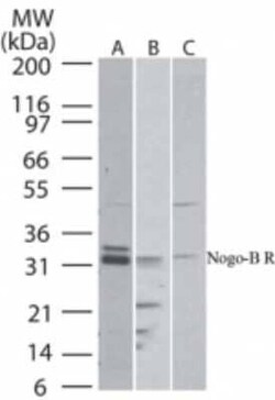 Invitrogen NUS1 Polyclonal Antibody 100 &mu;g | Buy Online | Invitrogen&trade; | Fisher Scientific