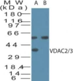 Invitrogen VDAC2/VDAC3 Polyclonal Antibody 100 &mu;g | Buy Online | Invitrogen&trade; | Fisher Scientific
