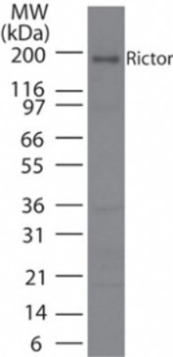 Invitrogen RICTOR Polyclonal Antibody 100 &mu;g; Unconjugated:Antibodies,