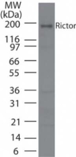 Invitrogen RICTOR Polyclonal Antibody 100 &mu;g | Buy Online | Invitrogen&trade; | Fisher Scientific