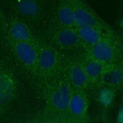 Invitrogen TIM-1 Polyclonal Antibody 100 &mu;g | Buy Online | Invitrogen&trade; | Fisher Scientific