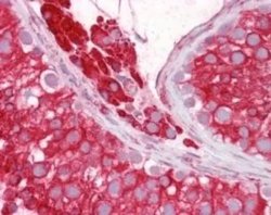 Invitrogen Nogo-A/B Polyclonal Antibody 200 &mu;L; Unconjugated:Antibodies,