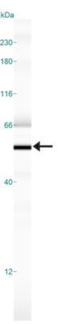Invitrogen Nogo-A/B Polyclonal Antibody 200 &mu;L; Unconjugated:Antibodies,