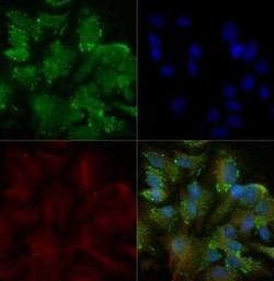 Invitrogen TRAIL-R2 (DR5) Polyclonal Antibody 100 &mu;g; Unconjugated:Antibodies,
