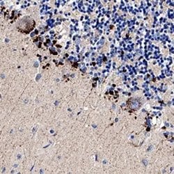 Invitrogen TRAIL-R2 (DR5) Polyclonal Antibody 100 &mu;g; Unconjugated:Antibodies,