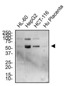 Invitrogen TRAIL-R2 (DR5) Polyclonal Antibody 100 &mu;g; Unconjugated:Antibodies,