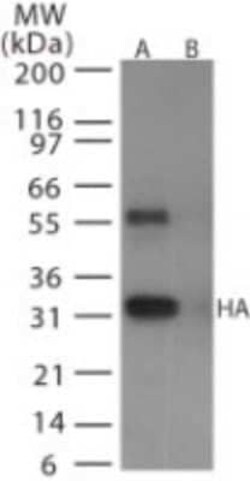 Invitrogen Influenza A H6N1 HA Polyclonal Antibody 100 &mu;g | Buy Online | Invitrogen&trade; | Fisher Scientific