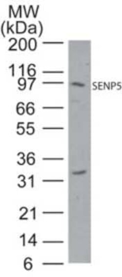 Invitrogen SENP5 Polyclonal Antibody 100 &mu;g | Buy Online | Invitrogen&trade; | Fisher Scientific