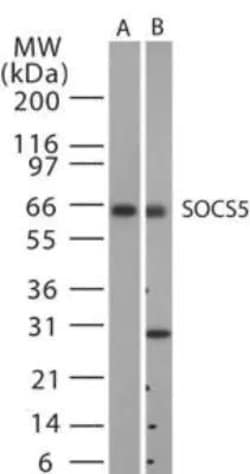 SOCS5 Polyclonal Antibody:Antibodies, Polyclonal