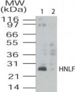 Invitrogen TMED4 Polyclonal Antibody 100 &mu;g; Unconjugated:Antibodies,