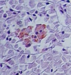 SENP2 Polyclonal Antibody:Antibodies, Polyclonal