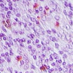 SENP2 Polyclonal Antibody:Antibodies, Polyclonal