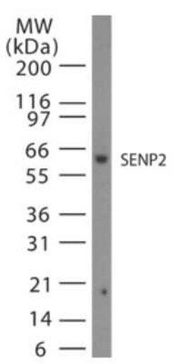 Invitrogen SENP2 Polyclonal Antibody 100 &mu;g | Buy Online | Invitrogen&trade; | Fisher Scientific