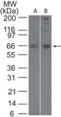 Invitrogen SENP2 Polyclonal Antibody 100 &mu;g | Buy Online | Invitrogen&trade; | Fisher Scientific