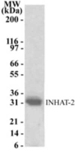 Invitrogen NOC2L Polyclonal Antibody 200 &mu;L | Buy Online | Invitrogen&trade; | Fisher Scientific