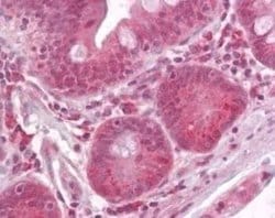 Invitrogen Raptor Polyclonal Antibody 200 &mu;L; Unconjugated:Antibodies,