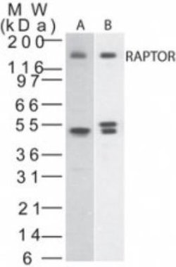 Invitrogen Raptor Polyclonal Antibody 200 &mu;L; Unconjugated:Antibodies,