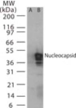 Invitrogen SARS Coronavirus Nucleocapsid Polyclonal Antibody 100 &mu;g | Buy Online | Invitrogen&trade; | Fisher Scientific