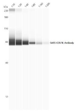 Invitrogen SARS Coronavirus Nucleocapsid Polyclonal Antibody 100 &mu;g | Buy Online | Invitrogen&trade; | Fisher Scientific