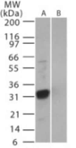 Invitrogen SARS Coronavirus 3b Polyclonal Antibody 200 &mu;L; Unconjugated:Antibodies,