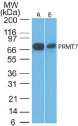 Invitrogen PRMT7 Polyclonal Antibody 100 &mu;g | Buy Online | Invitrogen&trade; | Fisher Scientific