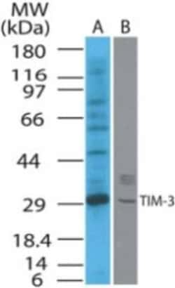 Invitrogen TIM3 Polyclonal Antibody 100 &mu;g | Buy Online | Invitrogen&trade; | Fisher Scientific