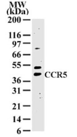 Invitrogen CCR5 Polyclonal Antibody 100 &mu;g; Unconjugated:Antibodies,