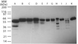 RNF216 Polyclonal Antibody:Antibodies, Polyclonal