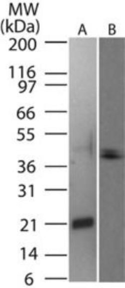 Invitrogen CD254 (RANK Ligand) Polyclonal Antibody 100 &mu;g; Unconjugated:Antibodies,