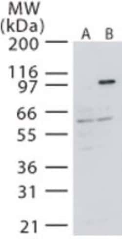 Invitrogen NIK Polyclonal Antibody 100 &mu;g; Unconjugated:Antibodies,