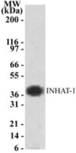 Invitrogen SET Polyclonal Antibody 100 &mu;g; Unconjugated:Antibodies,