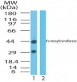 FNTA Polyclonal Antibody:Antibodies, Polyclonal