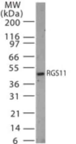 Invitrogen RGS11 Polyclonal Antibody 200 &mu;L | Buy Online | Invitrogen&trade; | Fisher Scientific