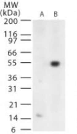 West Nile Virus Envelope Polyclonal Antibody:Antibodies, Polyclonal