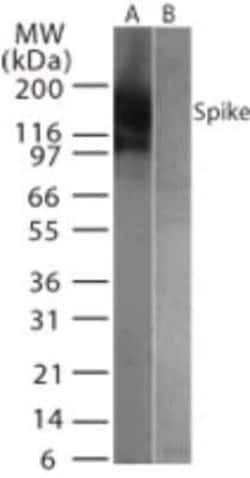 Invitrogen SARS Coronavirus Spike Protein Polyclonal Antibody 200 &mu;L | Buy Online | Invitrogen&trade; | Fisher Scientific