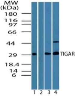 Invitrogen TIGAR Polyclonal Antibody 100 &mu;g; Unconjugated:Antibodies,