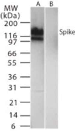 SARS Coronavirus Spike Protein Polyclonal Antibody:Antibodies, Polyclonal