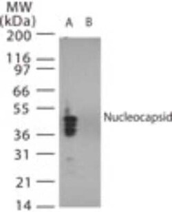 Invitrogen SARS Coronavirus Nucleocapsid Polyclonal Antibody 100 &mu;g | Buy Online | Invitrogen&trade; | Fisher Scientific