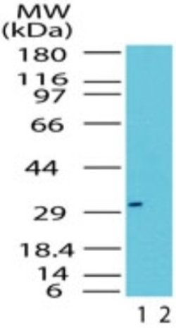 Invitrogen RAX Polyclonal Antibody 100 &mu;g; Unconjugated:Antibodies,