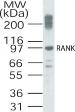 Invitrogen RANK Polyclonal Antibody 100 μg; Unconjugated:Antibodies,