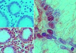 Invitrogen Nurim Polyclonal Antibody 100 &mu;g; Unconjugated:Antibodies,