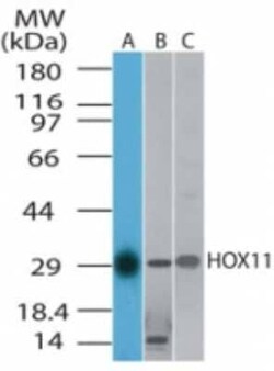 Invitrogen HOXA11 Polyclonal Antibody 100 &mu;g | Buy Online | Invitrogen&trade; | Fisher Scientific