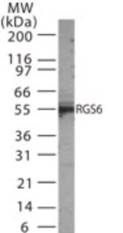 RGS6 Polyclonal Antibody:Antibodies, Polyclonal