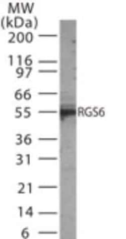 Invitrogen RGS6 Polyclonal Antibody 200 &mu;L | Buy Online | Invitrogen&trade; | Fisher Scientific