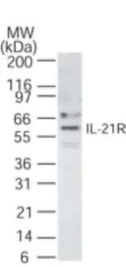 Invitrogen IL21R Polyclonal Antibody 100 &mu;g; Unconjugated:Antibodies,