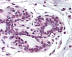 ZMYM2 Polyclonal Antibody:Antibodies, Polyclonal