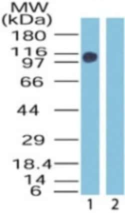 ZMYM2 Polyclonal Antibody:Antibodies, Polyclonal