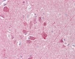 Invitrogen PGP9.5 Polyclonal Antibody 100 &mu;g | Buy Online | Invitrogen&trade; | Fisher Scientific